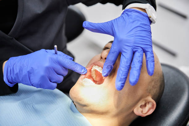 Best Urgent Care for Lost Fillings or Crowns in Gleneagle, CO