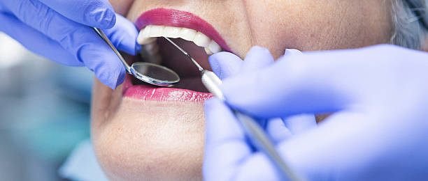 Best Same-Day Emergency Dental Services in Gleneagle, CO